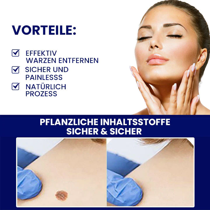 Wartsoff NanoPURI ointment for wart removal - Image 2