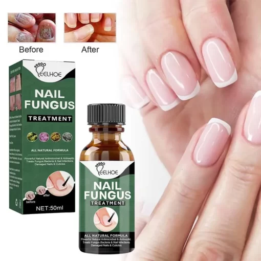 Anti-Funguses Nail Treatment - Image 2