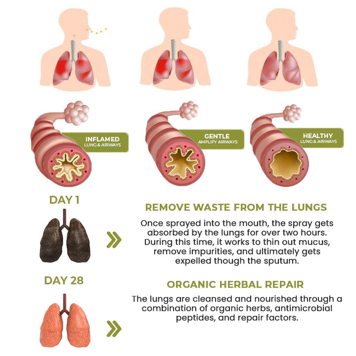 Natural Herbal Spray For Lung And Respiratory Support - Image 4