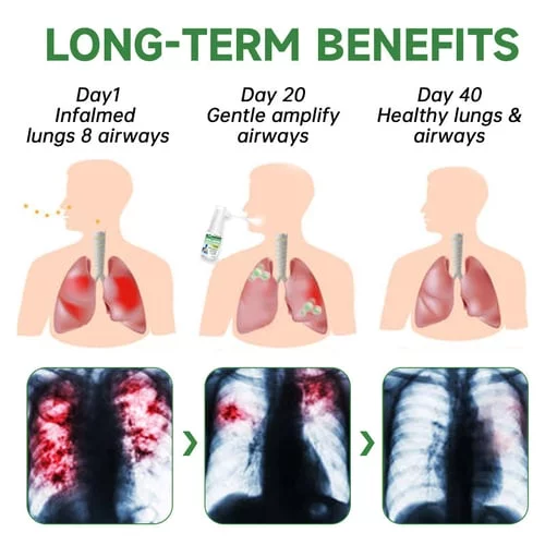 Herbal Lung and Breath Spray - Image 3