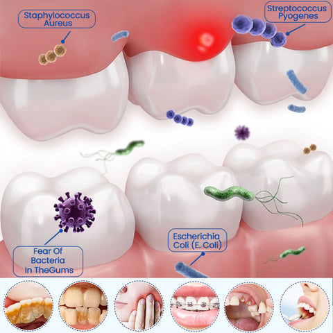Ceoerty™ Deluxe Herbal Oral Care - Image 4