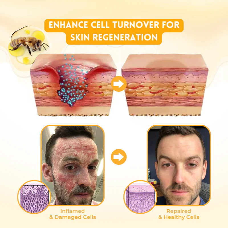 Bee Venom Multi-Action Ward Remover Cream - Image 7