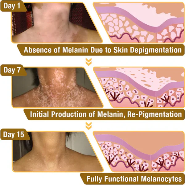 VitiGO™ Revitalizing Cream – Natural Skin Restoration & Vitality (IMPORTED ) - Image 5