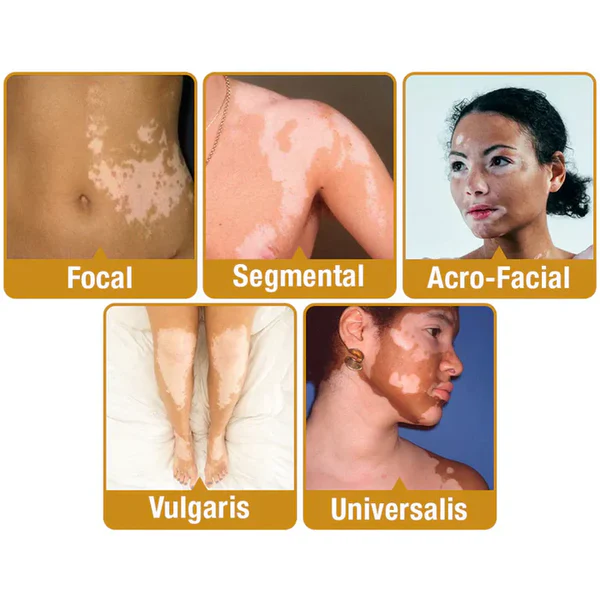 VitiGO™ Revitalizing Cream – Natural Skin Restoration & Vitality (IMPORTED ) - Image 6