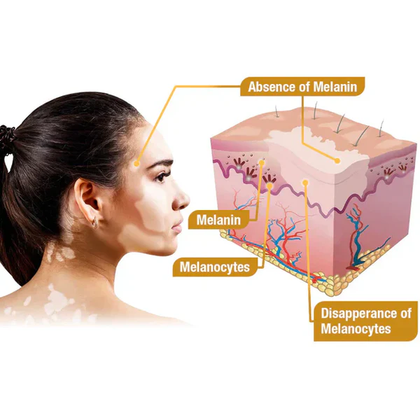 VitiGO™ Revitalizing Cream – Natural Skin Restoration & Vitality (IMPORTED ) - Image 7