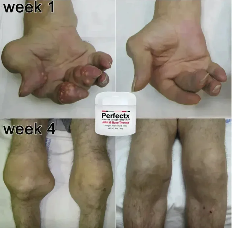 PERFECTX (JOINTS AND BONES THERAPY CREAM) - IMPORTED - Image 4