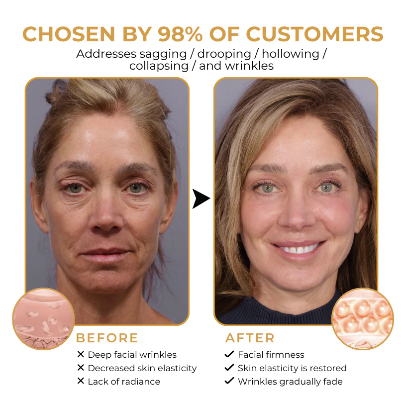 Biancat™ VenoGlow Botox Bee Venom Anti-Wrinkle Cream - Image 4