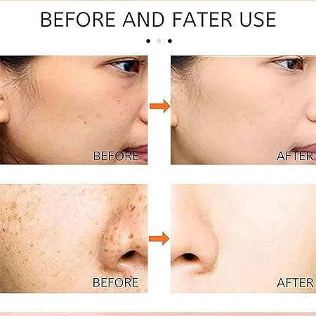 Saam Renewal Face Cream, Remove Wrinkles, Melasma, Freckles, Skin Aging, Dark skin - Image 4