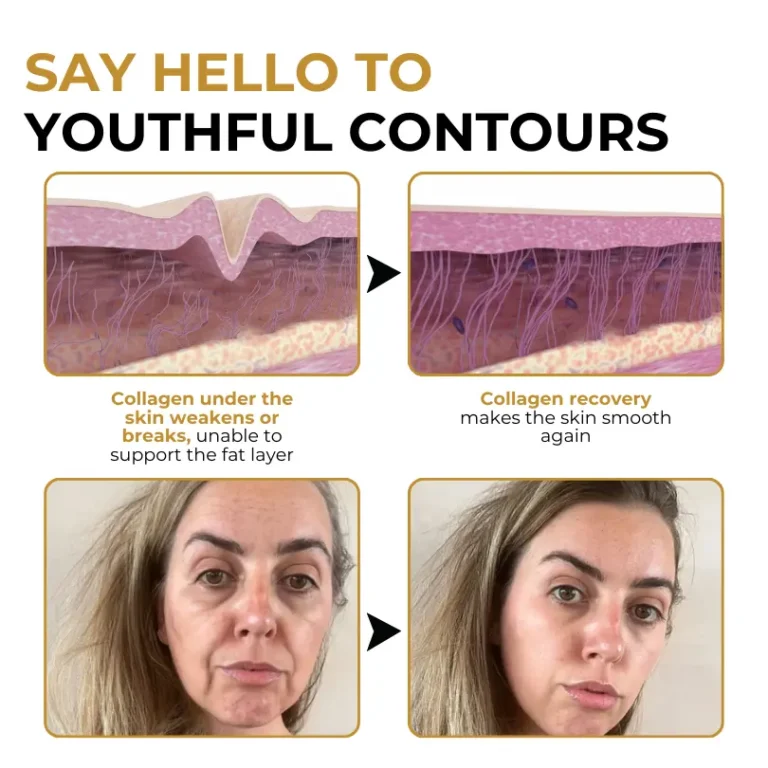 Biancat™ VenoGlow Botox Bee Venom Anti-Wrinkle Cream - Image 9
