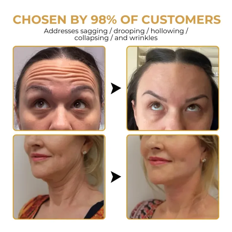 Biancat™ VenoGlow Botox Bee Venom Anti-Wrinkle Cream - Image 10