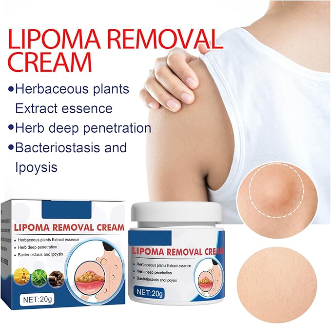 LIPOMA REMOVAL CREAM (IMPORTED) - Image 4