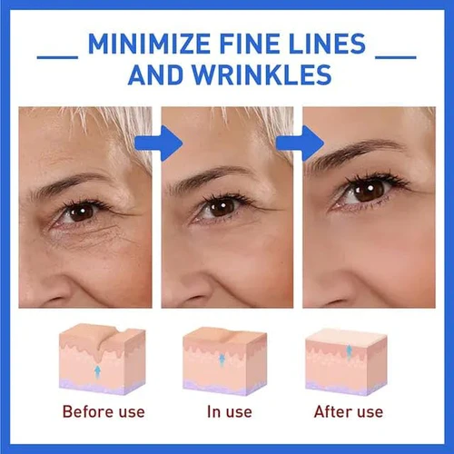 Botox Anti-Aging Serum - Image 6