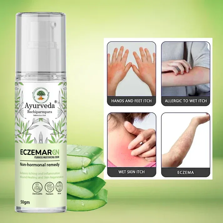 Eczemar GN – Ayurvedic Psoriasis & Eczema Moisturizing Cream - Image 3