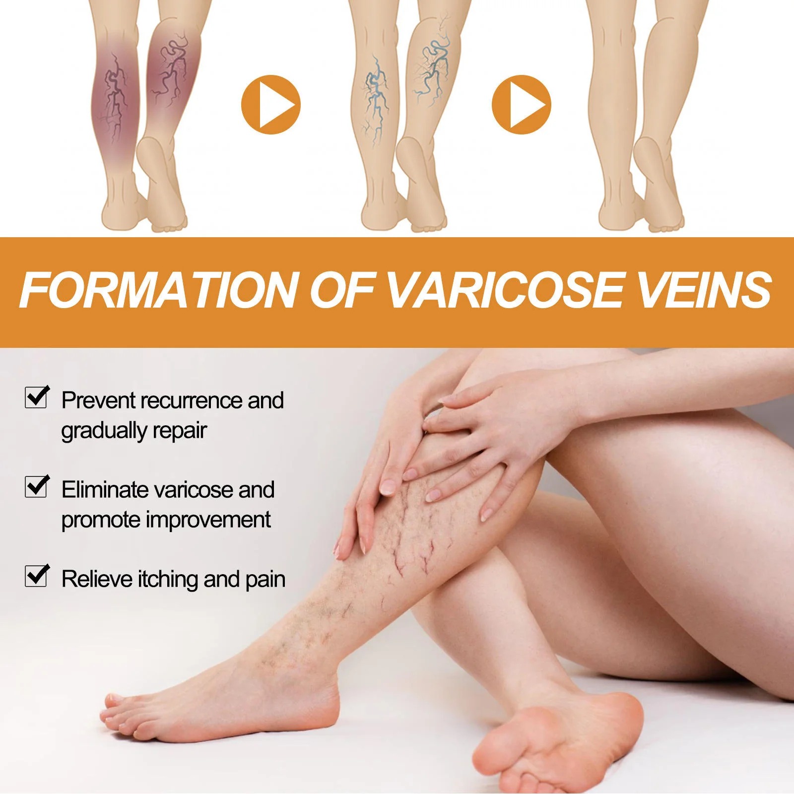 Varicose Vein Treatment Spray, Leg Varicose Vein Treatment - Image 5
