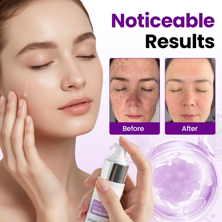 Biancat® SpotErase Probiotic Shield Serum - Image 10