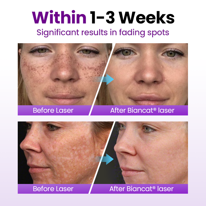 Biancat® SpotErase Probiotic Shield Serum - Image 9