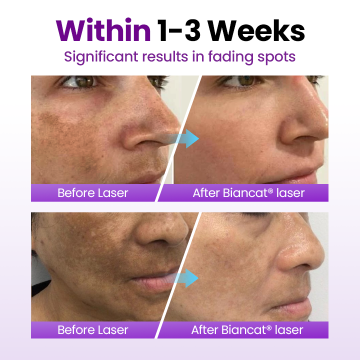 Biancat® SpotErase Probiotic Shield Serum - Image 8