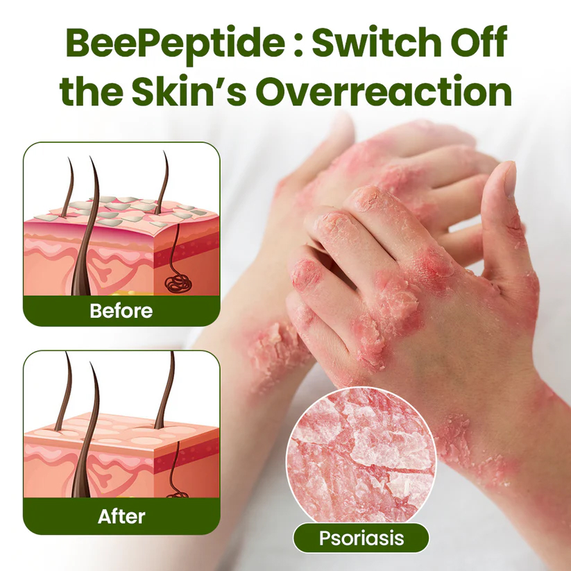 BeePeptide RootSoft DualRelief Cream - Image 9