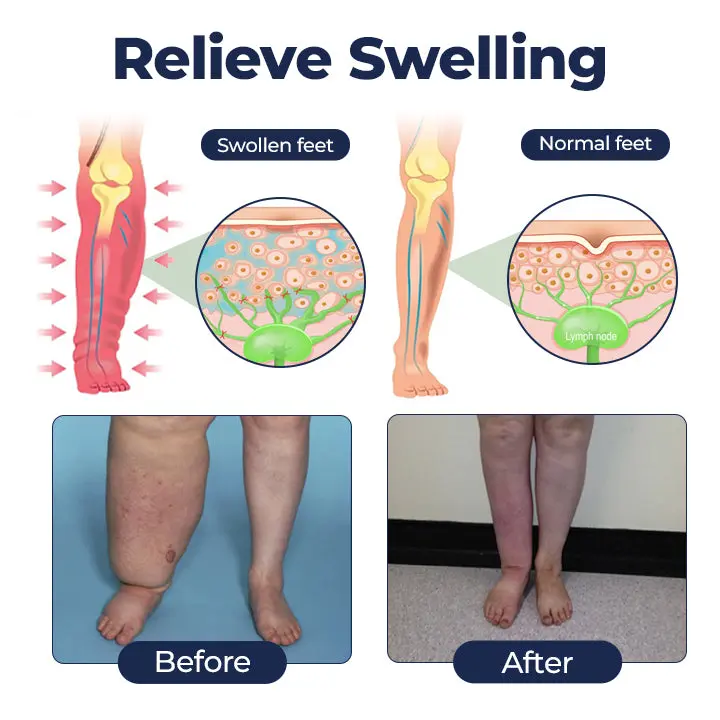 SwellRelief Circulation Support Cream - Image 4