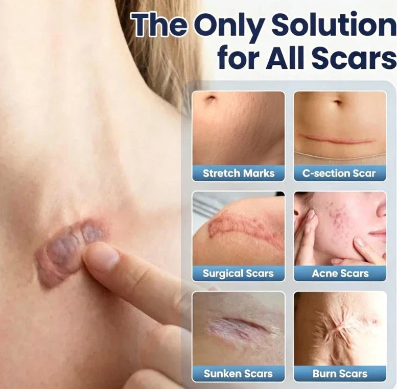 Scar Repair Cream - Image 4