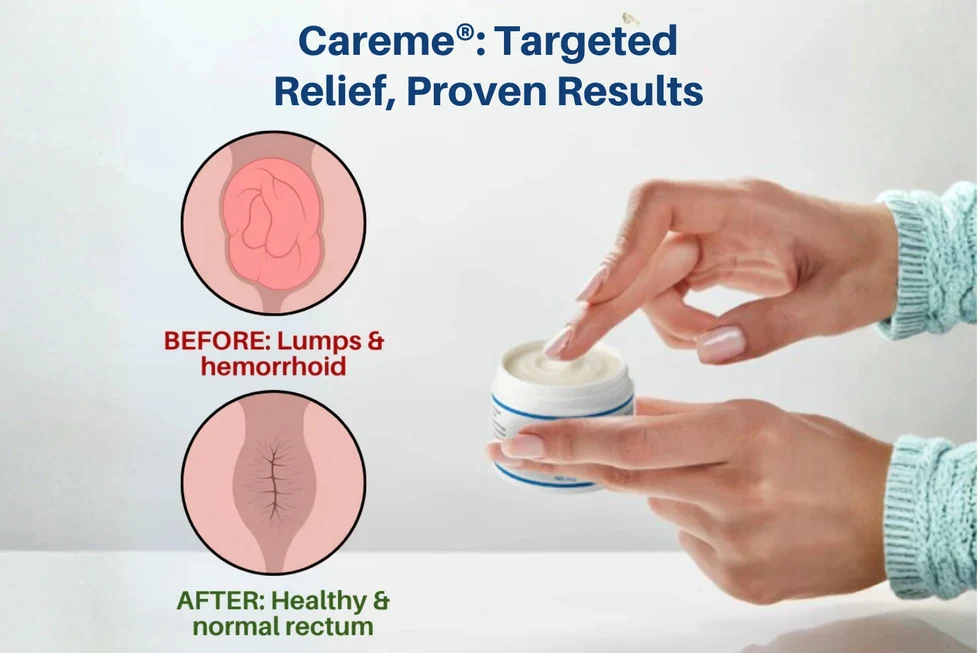 Maximum Strength Hemorrhoid & Fissure Treatment Cream - Image 3