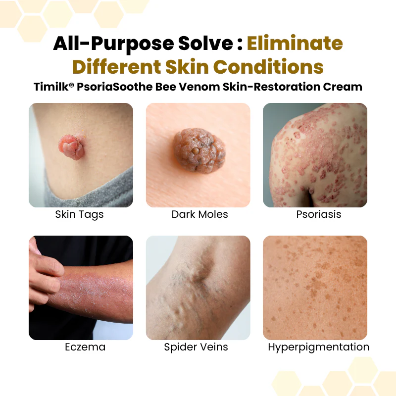 PsoriaSoothe Skin-Restoration Cream - Image 8