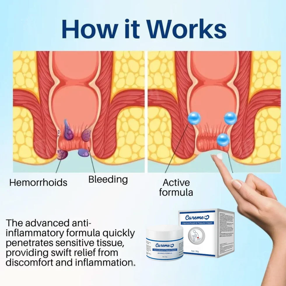 Maximum Strength Hemorrhoid & Fissure Treatment Cream - Image 4