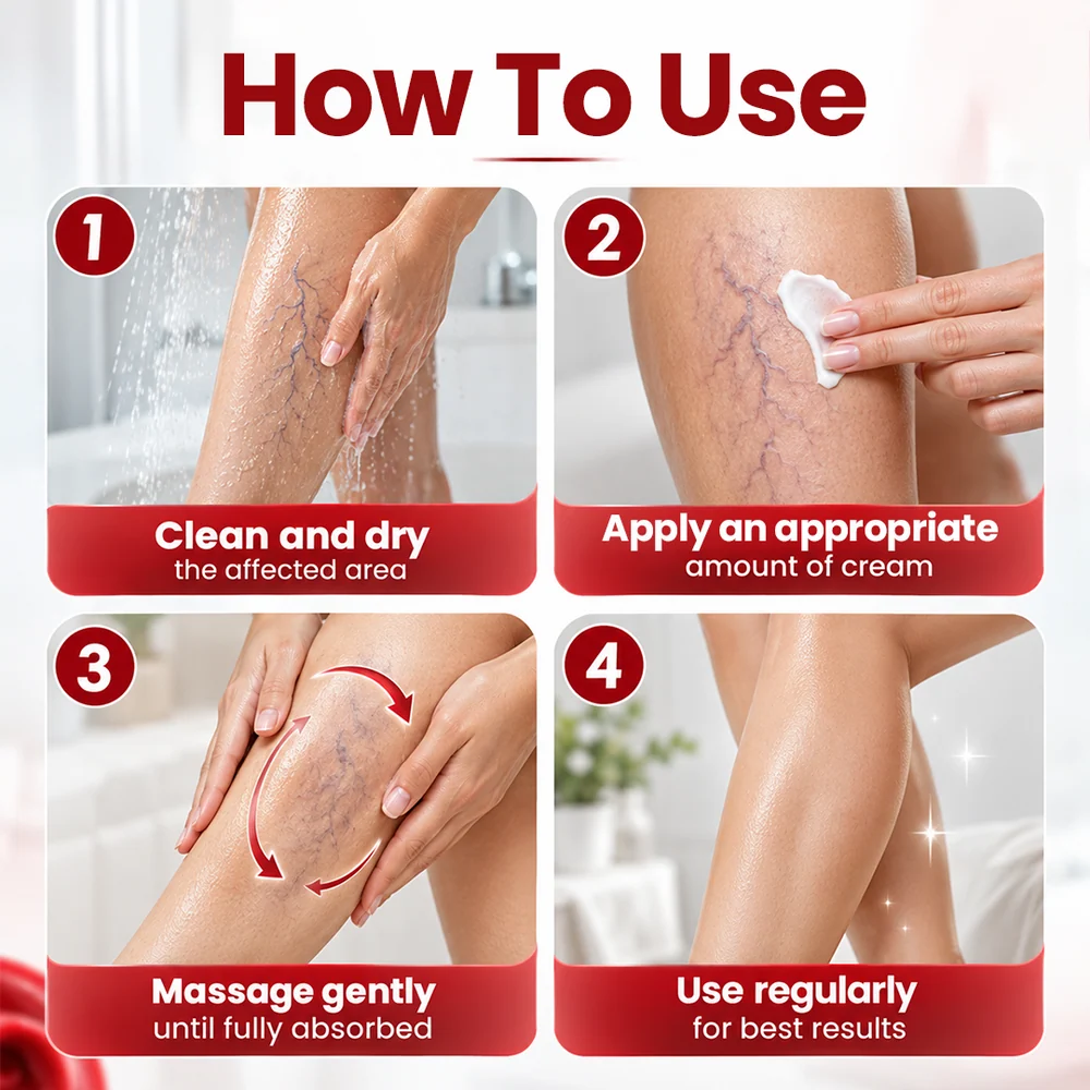Get Rid of Varicose & Spider Veins. Show Your Legs Again. - Image 2