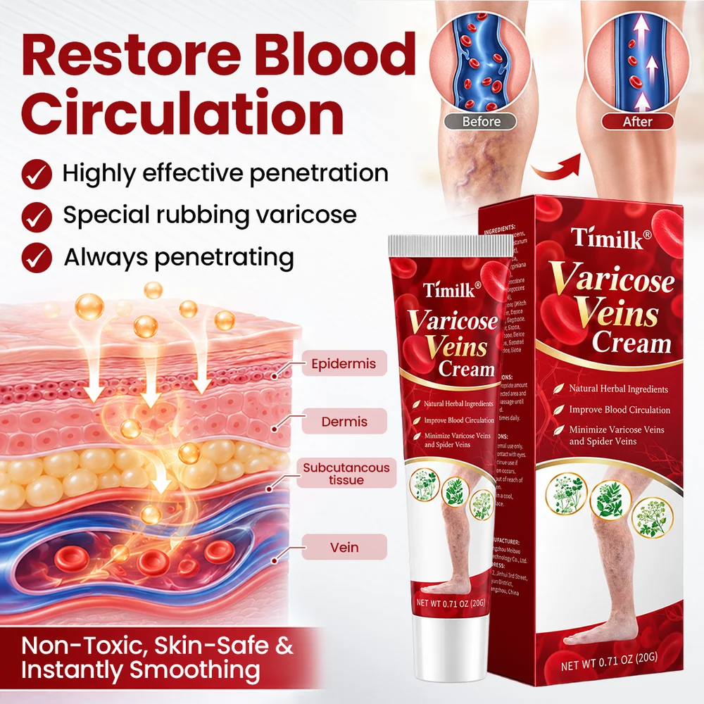 Get Rid of Varicose & Spider Veins. Show Your Legs Again. - Image 10