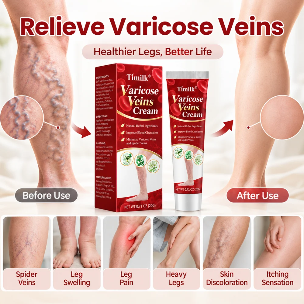 Get Rid of Varicose & Spider Veins. Show Your Legs Again. - Image 9